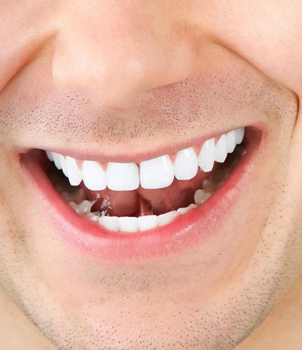 牙齒發(fā)黃變白小竅門(mén)，讓你的笑容更加自信璀璨，牙齒美白小竅門(mén)，重拾自信璀璨笑容的秘訣