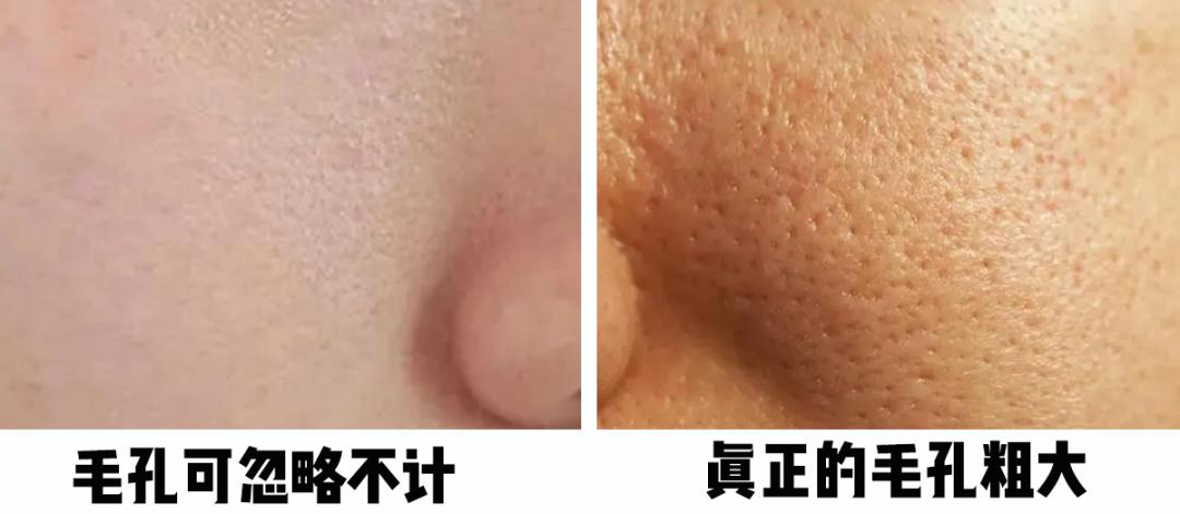 怎樣毛孔可以慢慢縮小，護(hù)膚秘籍與實(shí)用建議，護(hù)膚秘籍，縮小毛孔實(shí)用建議與指南