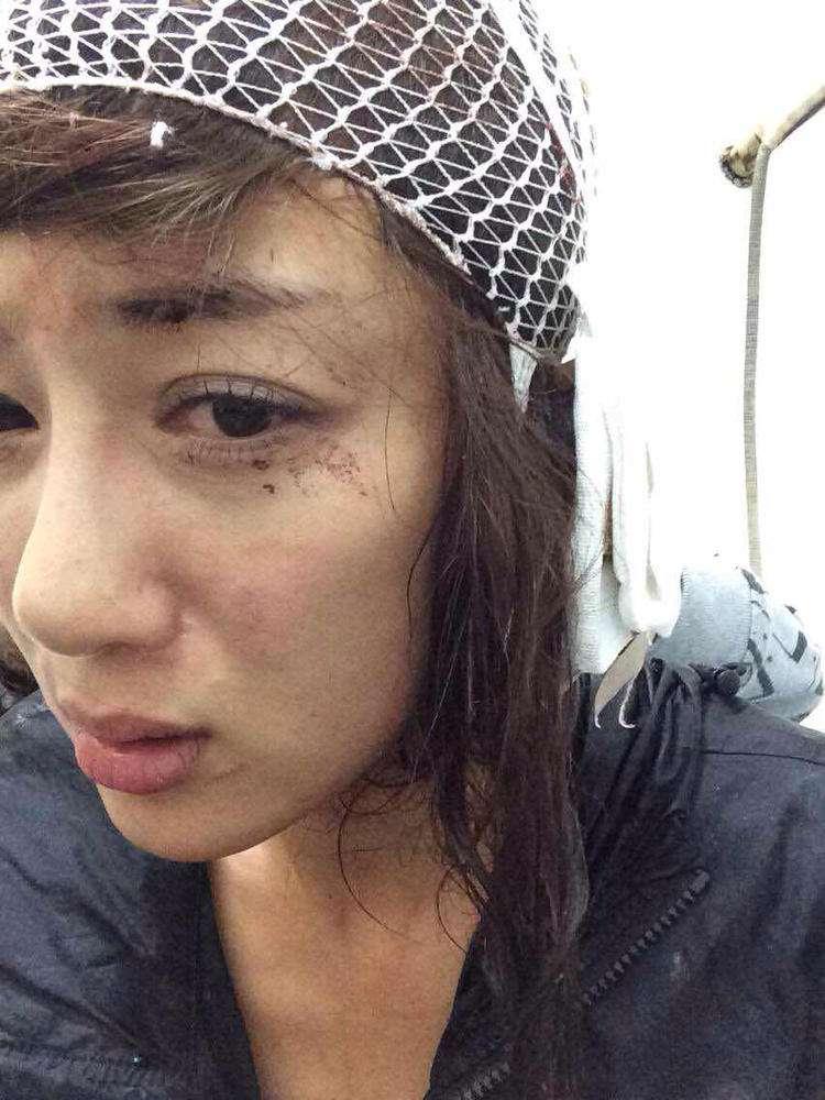 明星整容毀容最嚴(yán)重的是誰，深度探討與反思，深度探討與反思，哪位明星整容遭遇最慘重的毀容？