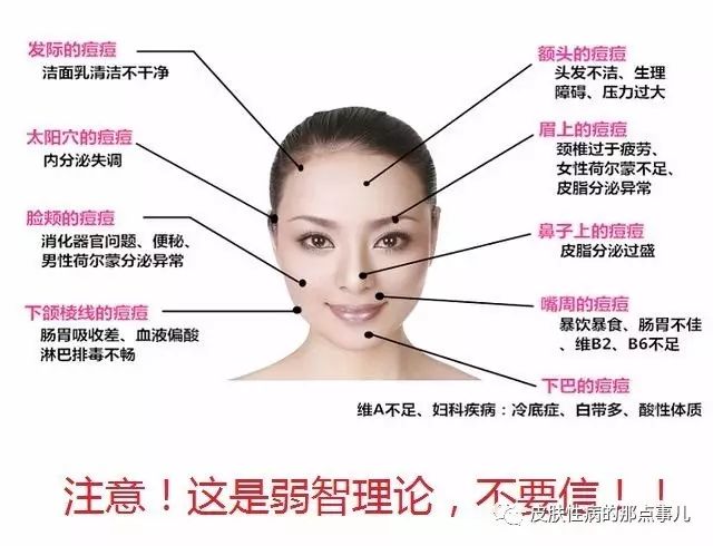 痘痘反復長是什么原因，痘痘反復長的原因分析