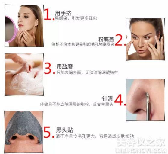 去黑頭的簡單小妙招，去黑頭小妙招分享，輕松告別黑頭困擾