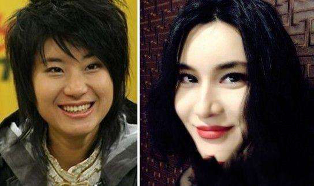 整容整丑了的明星，審美變遷下的遺憾案例，審美變遷下的明星整容遺憾案例，從美到丑的遺憾經(jīng)歷