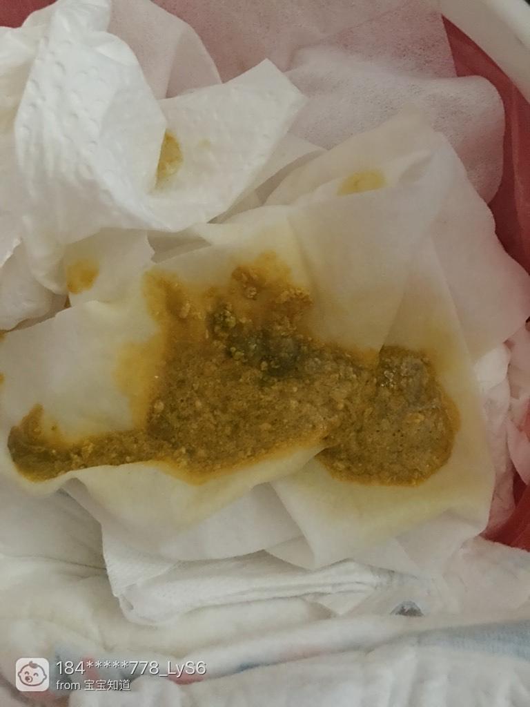 關(guān)于4個(gè)月的寶寶拉肚子怎么辦的全方位指南，4個(gè)月寶寶拉肚子應(yīng)對(duì)指南，全方位解決方案