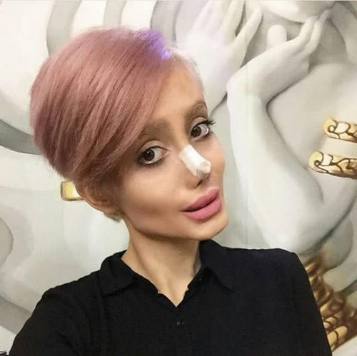 整容最瘋狂的女人，背后的故事與心理探索，整容狂熱背后的女人故事與心理揭秘