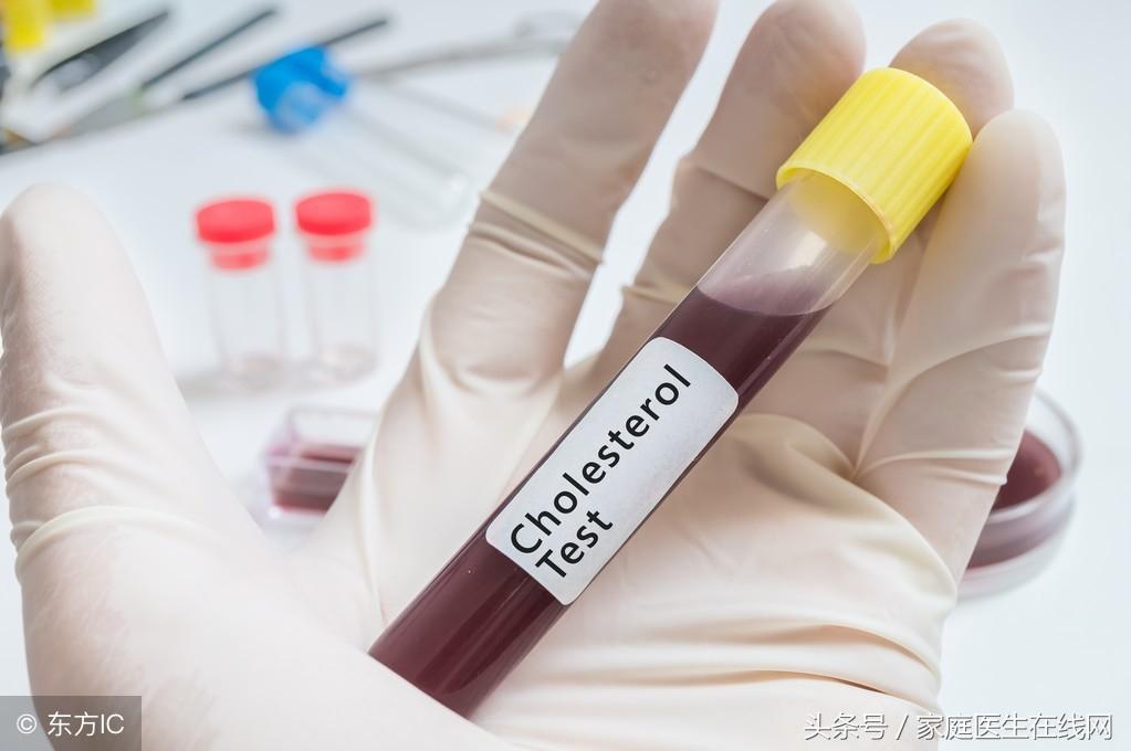 糖尿病的成因，深度解析其背后的原因，深度解析糖尿病成因，揭示背后原因真相