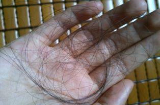 為什么有錢人不去植發(fā)，深度解析背后的原因，深度解析，有錢人為什么不去植發(fā)的原因