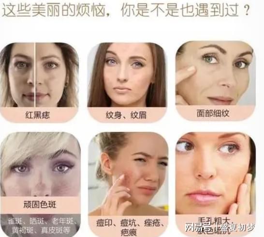 激光祛斑真害人？深度解析激光祛斑的利與弊，深度解析，激光祛斑的利弊與潛在風(fēng)險(xiǎn)揭秘