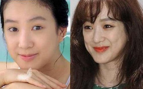 揭秘，韓國整容失敗的十大明星，揭秘，韓國整容失敗的明星TOP 10名單曝光