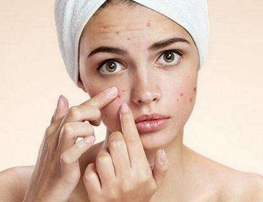 如何去掉青春痘小妙招，實(shí)用指南助你擺脫肌膚困擾，青春痘消除小妙招，實(shí)用指南助你擺脫肌膚問題