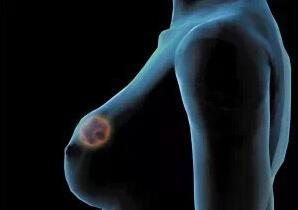 乳腺癌患者的生存期，了解與面對(duì)，乳腺癌患者的生存期，了解與面對(duì)的挑戰(zhàn)