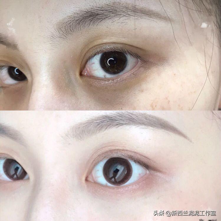 眼紋嚴重？快速有效的去眼紋方法大揭秘，揭秘快速有效的去眼紋方法，告別眼部皺紋煩惱！