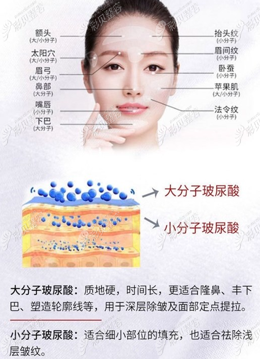 玻尿酸的作用與功效，深入了解玻尿酸的奧秘，玻尿酸的作用與功效揭秘，深入了解玻尿酸的神奇之處