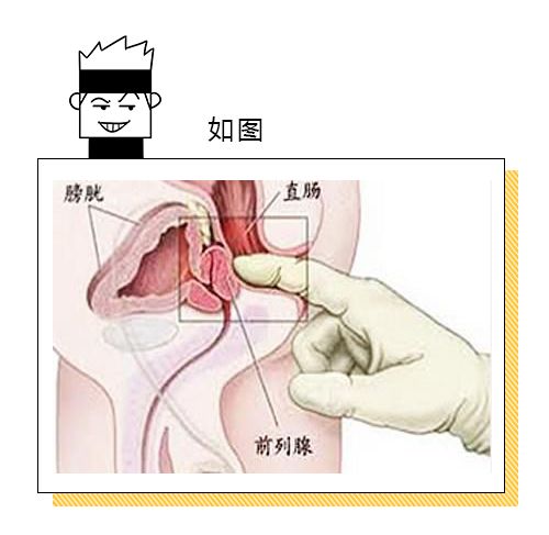 前列腺按摩手法與位置指南，全面解析與實踐，前列腺按摩手法與位置指南，全面解析與實踐技巧