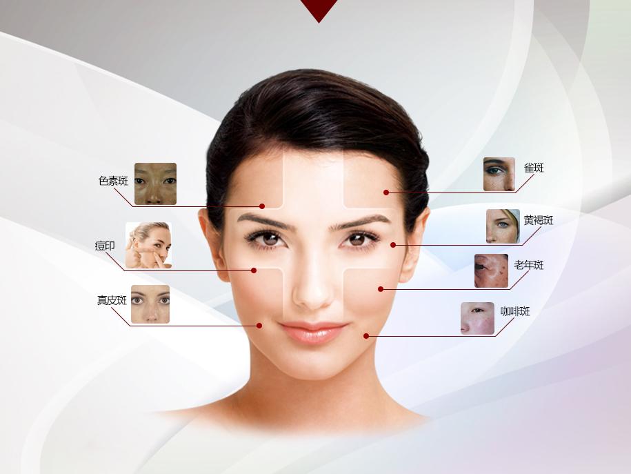 激光祛斑，一次能否徹底去除斑點(diǎn)？，激光祛斑能否一次徹底去除斑點(diǎn)？