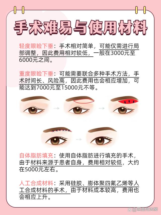 眼瞼下垂手術(shù)費(fèi)用詳解，大約多少錢？，眼瞼下垂手術(shù)費(fèi)用解析，手術(shù)費(fèi)用究竟是多少？