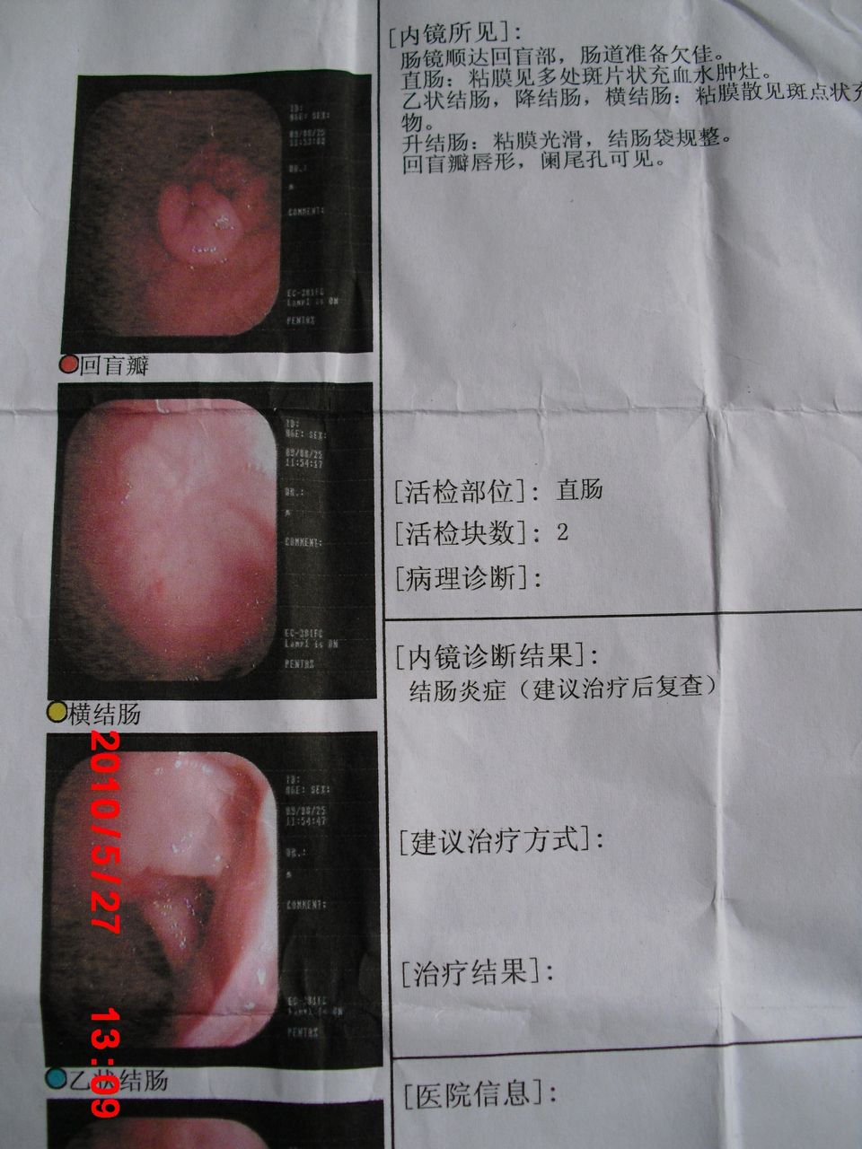 結(jié)腸炎患者應(yīng)該吃什么藥？全面解析治療方案，結(jié)腸炎患者全面解析治療方案，藥物治療指南
