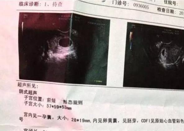 懷孕三個(gè)月自測(cè)男女，了解胎兒性別預(yù)測(cè)方法及注意事項(xiàng)，懷孕三個(gè)月胎兒性別預(yù)測(cè)方法及注意事項(xiàng)，自測(cè)男女須知