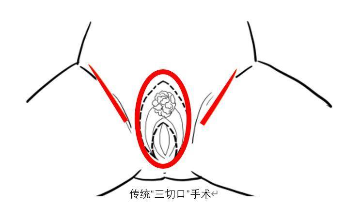 正常陰脣圖片，了解、識(shí)別與重要性，正常陰脣圖片，了解、識(shí)別及其重要性