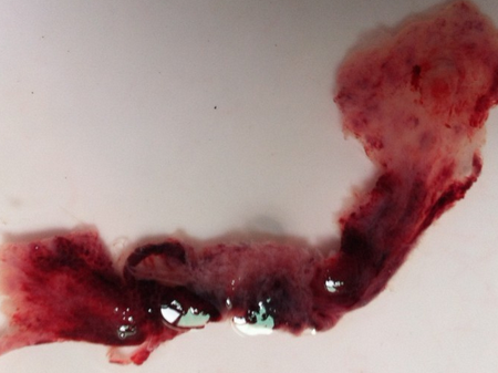 關(guān)于孕囊掉落的圖片，懷孕初期的生理變化與經(jīng)驗(yàn)分享，孕囊掉落圖片及懷孕初期生理變化與經(jīng)驗(yàn)分享