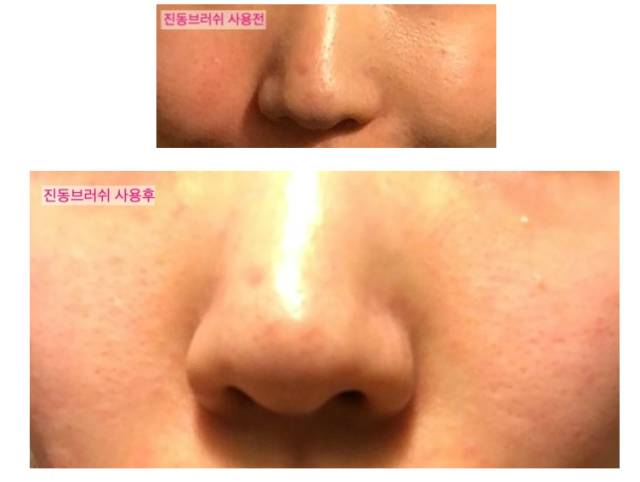 激光美白，讓你膚色煥新，白幾個度不再是夢，激光美白，重塑膚色，白皙煥新不再是夢