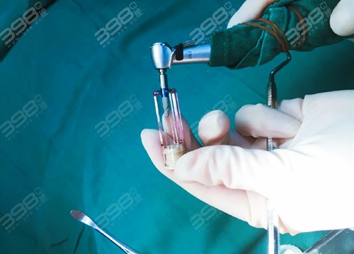 正規(guī)醫(yī)院拔智齒收費標(biāo)準(zhǔn)詳解，正規(guī)醫(yī)院拔智齒的收費標(biāo)準(zhǔn)詳解