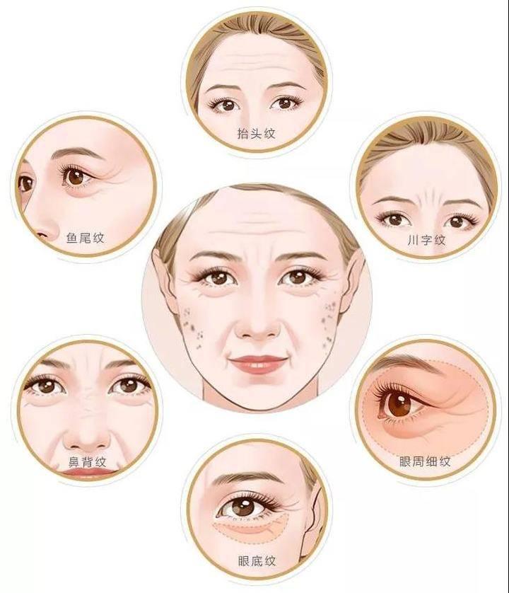 去魚尾紋用什么最好的方法——全面解析抗皺秘訣，去魚尾紋的最佳方法，全面解析抗皺秘訣