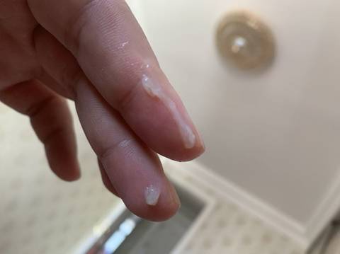 關(guān)于性行為后白帶增多的原因解析，性行為后白帶增多原因解析，揭秘背后的健康隱患