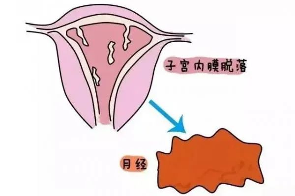 子宮內膜增厚能自愈嗎？解析與探討，子宮內膜增厚能否自愈？深度解析與探討