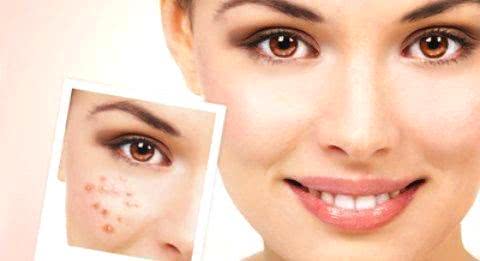 臉上長(zhǎng)斑的原因及其影響因素，深度解析，深度解析，臉上長(zhǎng)斑的原因及其影響因素