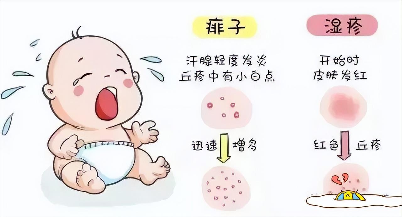 痱子和濕疹的區(qū)別，深入了解兩種常見皮膚狀況，痱子和濕疹的區(qū)別，常見皮膚狀況詳解